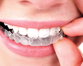 A Brief History Of Braces